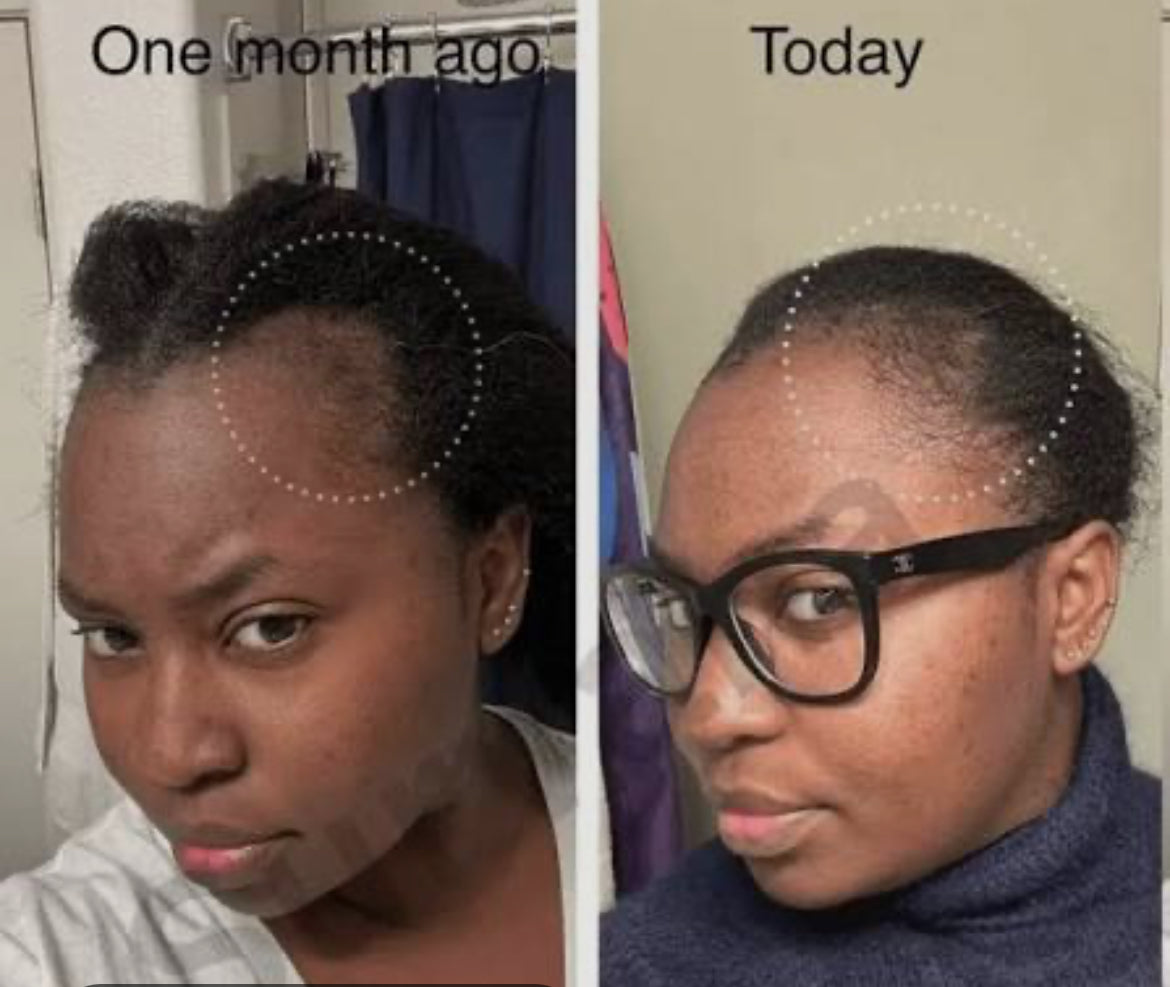 Peptide Hair Growth Serum