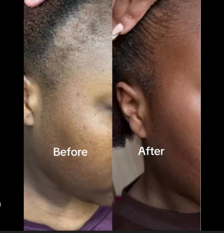 Peptide Hair Growth Serum