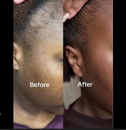 Peptide Hair Growth Serum